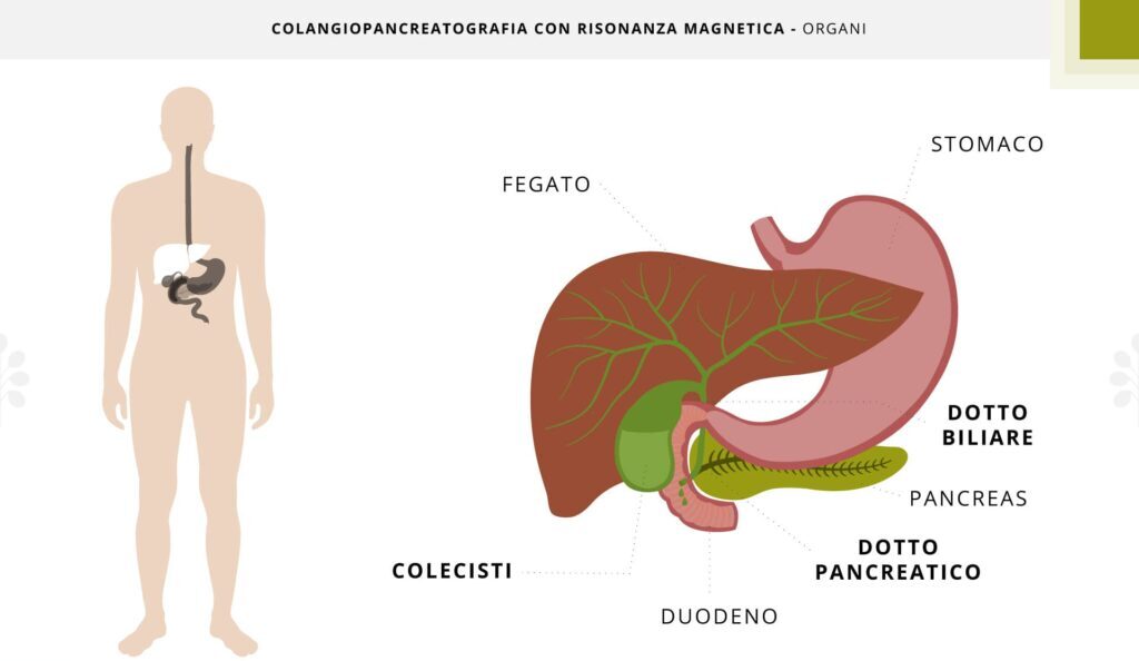 colangiopancreatografia con risonanza magnetica 1024x683